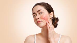 Discover Tips on How to Overcome Skin Rashes Here post thumbnail image
